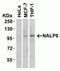NLR Family Pyrin Domain Containing 6 antibody, NBP2-81856, Novus Biologicals, Western Blot image 