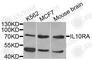 Interleukin 10 Receptor Subunit Alpha antibody, A1830, ABclonal Technology, Western Blot image 
