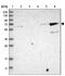 Kelch Like Family Member 26 antibody, NBP2-34187, Novus Biologicals, Western Blot image 