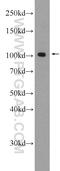 HSS antibody, 24423-1-AP, Proteintech Group, Enzyme Linked Immunosorbent Assay image 