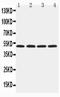 Hyaluronidase 1 antibody, LS-C343926, Lifespan Biosciences, Western Blot image 