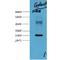 Galectin 3 antibody, LS-C387338, Lifespan Biosciences, Western Blot image 