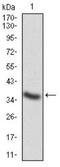 Cathepsin D antibody, NBP2-52451, Novus Biologicals, Western Blot image 