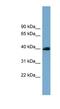 SAM And SH3 Domain Containing 3 antibody, NBP1-56887, Novus Biologicals, Western Blot image 