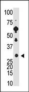 Recoverin antibody, 58-189, ProSci, Western Blot image 