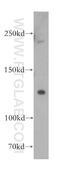 F-Box And Leucine Rich Repeat Protein 13 antibody, 17139-1-AP, Proteintech Group, Western Blot image 