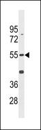 Cyclin Dependent Kinase 14 antibody, LS-C157904, Lifespan Biosciences, Western Blot image 