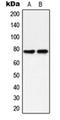 Protein Kinase C Delta antibody, orb216182, Biorbyt, Western Blot image 