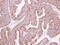 Kelch Like Family Member 2 antibody, NBP2-17080, Novus Biologicals, Immunohistochemistry frozen image 