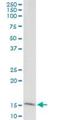 Golgin A7 antibody, H00051125-M01, Novus Biologicals, Immunoprecipitation image 