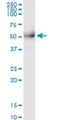 Metallophosphoesterase 1 antibody, H00065258-M08, Novus Biologicals, Western Blot image 