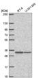 Transmembrane Protein 81 antibody, NBP2-57182, Novus Biologicals, Western Blot image 