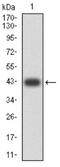 Glutamate Metabotropic Receptor 8 antibody, NBP2-61857, Novus Biologicals, Western Blot image 