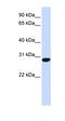 Zinc Finger C2HC-Type Containing 1B antibody, orb325652, Biorbyt, Western Blot image 