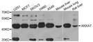 Annexin A7 antibody, A3733, ABclonal Technology, Western Blot image 