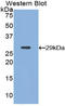 Integrin alpha-D antibody, LS-C297623, Lifespan Biosciences, Western Blot image 