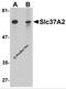Solute Carrier Family 37 Member 2 antibody, 5647, ProSci Inc, Western Blot image 