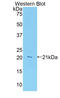 Leukocyte Associated Immunoglobulin Like Receptor 1 antibody, LS-C295147, Lifespan Biosciences, Western Blot image 