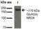 Glutamate Ionotropic Receptor NMDA Type Subunit 2A antibody, NBP2-22404, Novus Biologicals, Western Blot image 