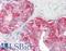 Acid Phosphatase, Prostate antibody, LS-B8309, Lifespan Biosciences, Immunohistochemistry paraffin image 