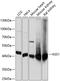 Argininosuccinate Synthase 1 antibody, GTX66412, GeneTex, Western Blot image 