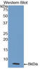 Interleukin 18 Receptor 1 antibody, LS-C294875, Lifespan Biosciences, Western Blot image 