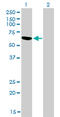 RNA Binding Motif Protein 5 antibody, LS-B4492, Lifespan Biosciences, Western Blot image 