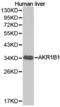 Aldose reductase antibody, LS-C192693, Lifespan Biosciences, Western Blot image 