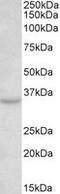 Tetraspanin 5 antibody, MBS423175, MyBioSource, Western Blot image 