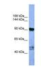 Adaptor Related Protein Complex 2 Subunit Alpha 2 antibody, NBP1-68948, Novus Biologicals, Western Blot image 