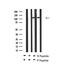 TEK Receptor Tyrosine Kinase antibody, GTX00793, GeneTex, Western Blot image 