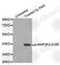 Mitogen-Activated Protein Kinase Kinase 3 antibody, AP0389, ABclonal Technology, Western Blot image 