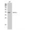 Acyl-CoA Wax Alcohol Acyltransferase 1 antibody, LS-C383116, Lifespan Biosciences, Western Blot image 