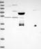 Coiled-Coil Domain Containing 66 antibody, NBP1-91761, Novus Biologicals, Western Blot image 