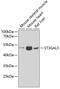 ST3 Beta-Galactoside Alpha-2,3-Sialyltransferase 3 antibody, GTX33520, GeneTex, Western Blot image 