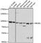 Phosphoinositide-3-Kinase Regulatory Subunit 1 antibody, LS-C746904, Lifespan Biosciences, Western Blot image 