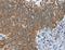 Ankyrin Repeat And KH Domain Containing 1 antibody, LS-C401426, Lifespan Biosciences, Immunohistochemistry paraffin image 