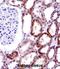 CD70 Molecule antibody, abx028268, Abbexa, Immunohistochemistry frozen image 