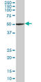 Tubulin Alpha 1a antibody, LS-C198502, Lifespan Biosciences, Western Blot image 