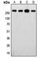 FASN antibody, LS-B14358, Lifespan Biosciences, Western Blot image 