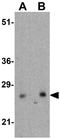 Collagen Triple Helix Repeat Containing 1 antibody, GTX31944, GeneTex, Western Blot image 