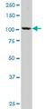 N-Acetyl-Alpha-Glucosaminidase antibody, H00004669-M02, Novus Biologicals, Western Blot image 