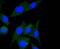 Integrin Linked Kinase antibody, GTX01046, GeneTex, Immunofluorescence image 