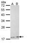 Phospholipase A2 Group XIIA antibody, GTX112060, GeneTex, Western Blot image 