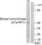 Protein Tyrosine Kinase 6 antibody, PA5-38413, Invitrogen Antibodies, Western Blot image 