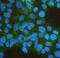 Interferon Alpha And Beta Receptor Subunit 2 antibody, A02056-3, Boster Biological Technology, Immunofluorescence image 