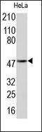 Tubulin Alpha 1b antibody, 251814, Abbiotec, Western Blot image 