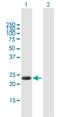 Calcium-binding protein 7 antibody, H00164633-B01P, Novus Biologicals, Western Blot image 