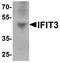 Interferon Induced Protein With Tetratricopeptide Repeats 3 antibody, A03920, Boster Biological Technology, Western Blot image 
