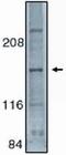 Mitogen-Activated Protein Kinase Kinase Kinase 5 antibody, PA1-12518, Invitrogen Antibodies, Western Blot image 
